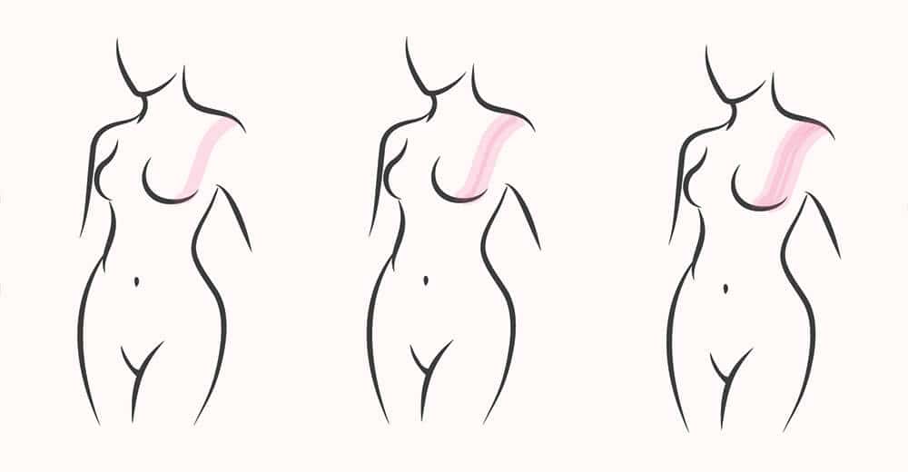 breast taping method